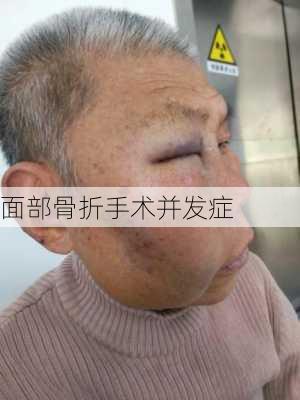 面部骨折手术并发症