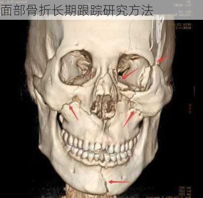 面部骨折长期跟踪研究方法