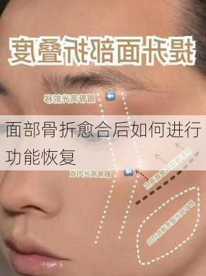 面部骨折愈合后如何进行功能恢复