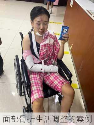 面部骨折生活调整的案例