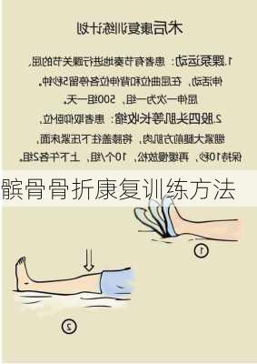 髌骨骨折康复训练方法