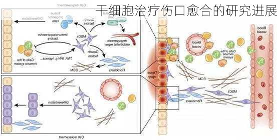 干细胞治疗伤口愈合的研究进展