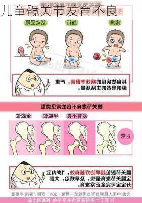 儿童髋关节发育不良