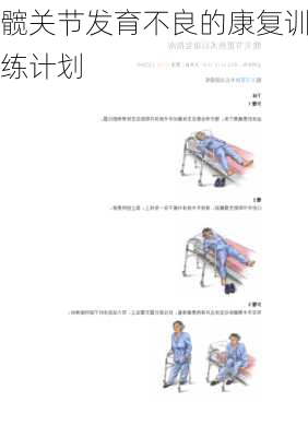 髋关节发育不良的康复训练计划