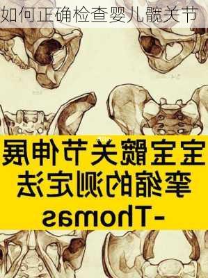 如何正确检查婴儿髋关节