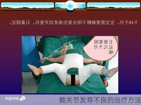 髋关节发育不良的治疗方法