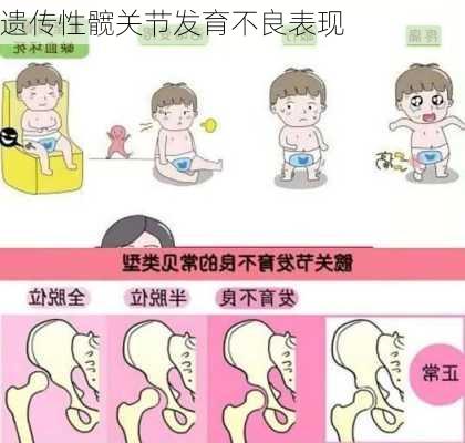 遗传性髋关节发育不良表现