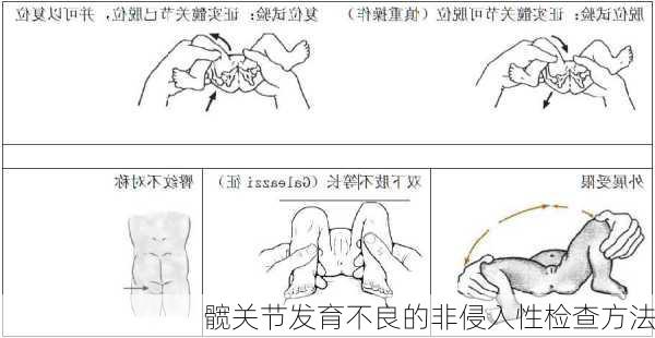 髋关节发育不良的非侵入性检查方法