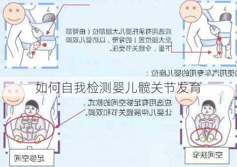 如何自我检测婴儿髋关节发育