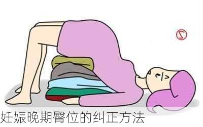 妊娠晚期臀位的纠正方法