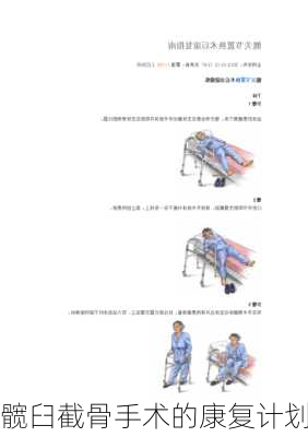 髋臼截骨手术的康复计划