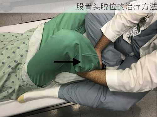 股骨头脱位的治疗方法