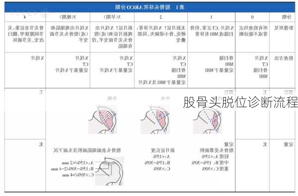 股骨头脱位诊断流程