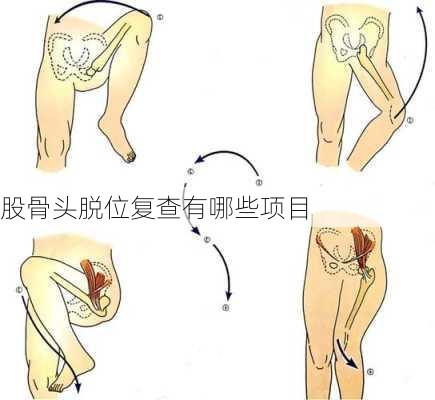 股骨头脱位复查有哪些项目