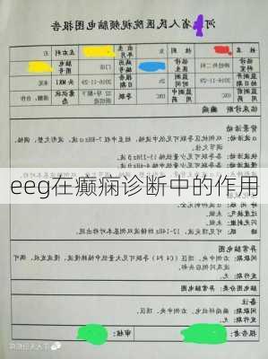 eeg在癫痫诊断中的作用