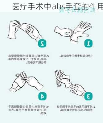 医疗手术中abs手套的作用