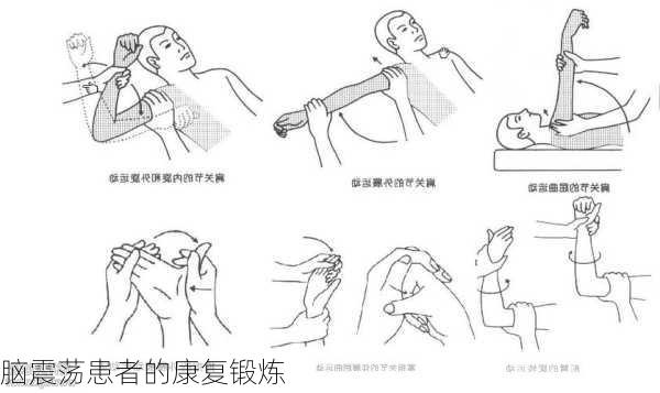 脑震荡患者的康复锻炼
