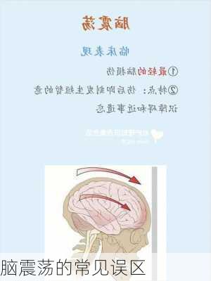 脑震荡的常见误区