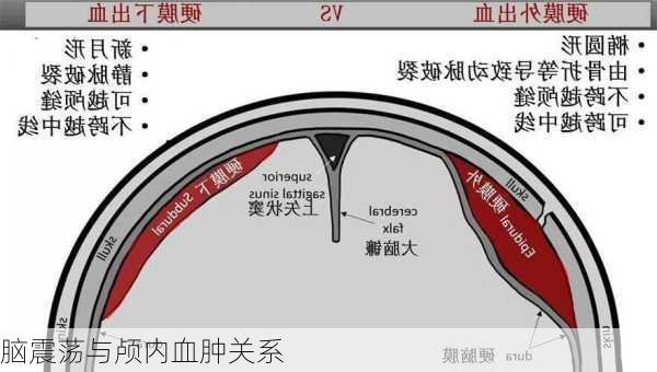 脑震荡与颅内血肿关系
