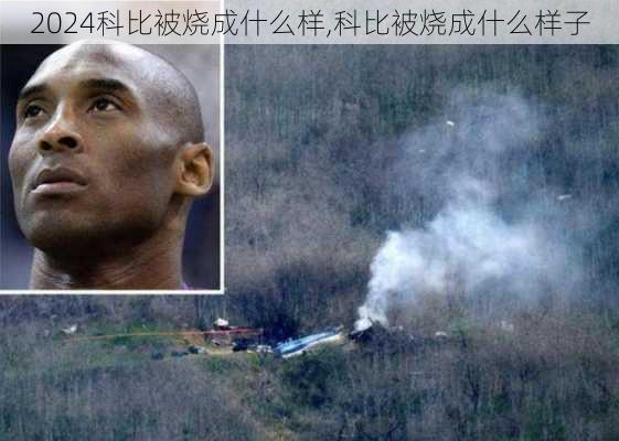 科比被烧成什么样,科比被烧成什么样子