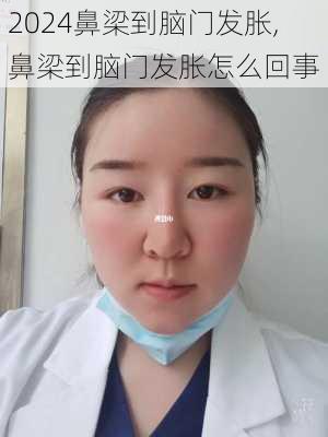 鼻梁到脑门发胀,鼻梁到脑门发胀怎么回事