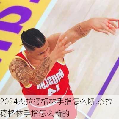 杰拉德格林手指怎么断,杰拉德格林手指怎么断的